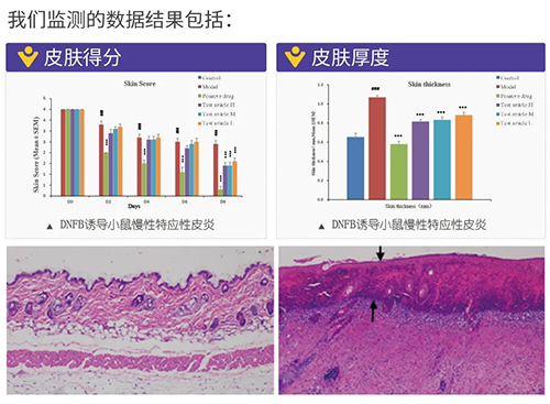 人生就是博建立的特应性皮炎及湿疹模型监测数据结果