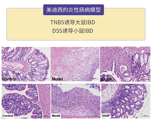 人生就是博的炎症性肠病模型