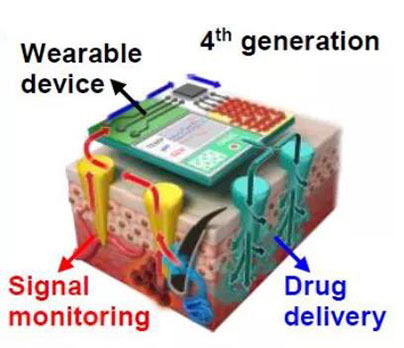 第四代透皮给药技术：在可穿戴设备的帮助下，用于患者定制治疗.jpg